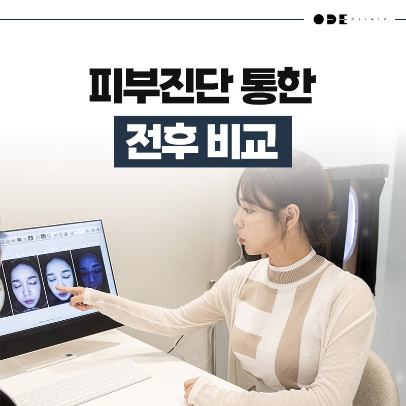 조합 시술