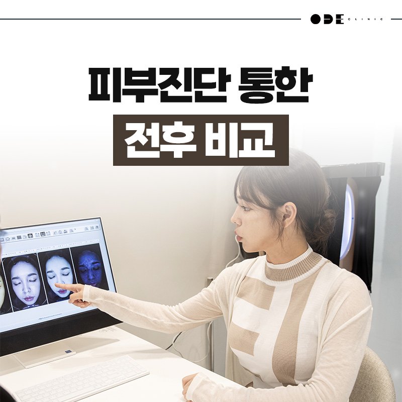 맞춤형 시술